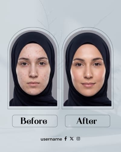 قالب Design Before and After for Skin Improvement, download and edit for free من أندلسي