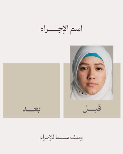 قالب Design Before and After, download and edit for free من أندلسي