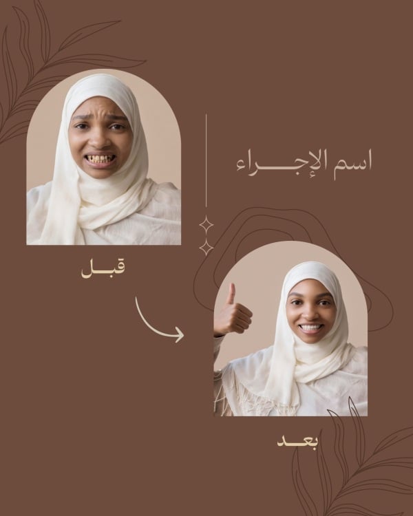 Before and After Design, download and edit for free design template - Before and After from the Andalusi design app