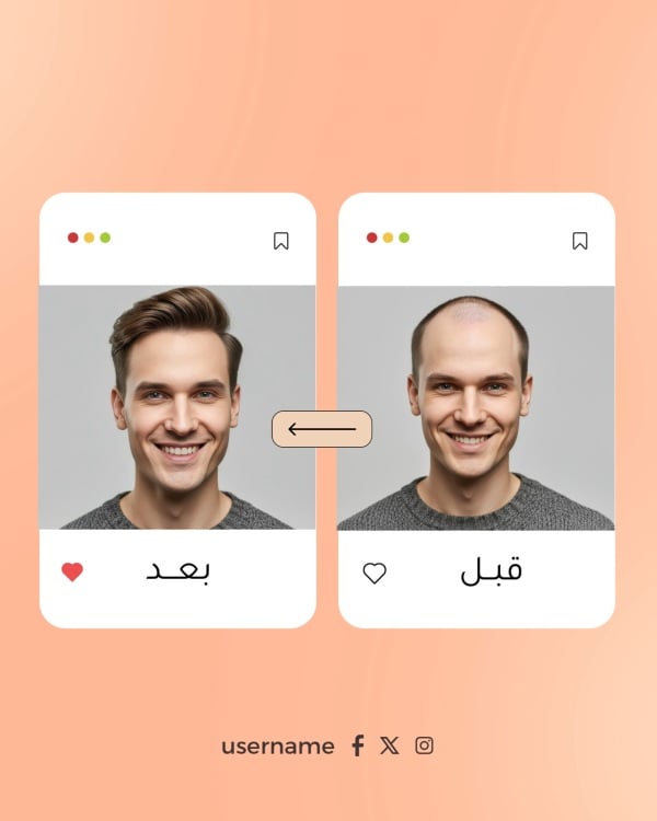 Before and After Design for Appearance Change, download and edit for free design template - Before and After from the Andalusi design app